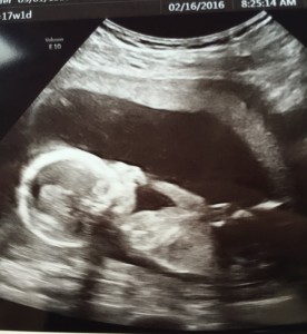 ultrasound of baby boy